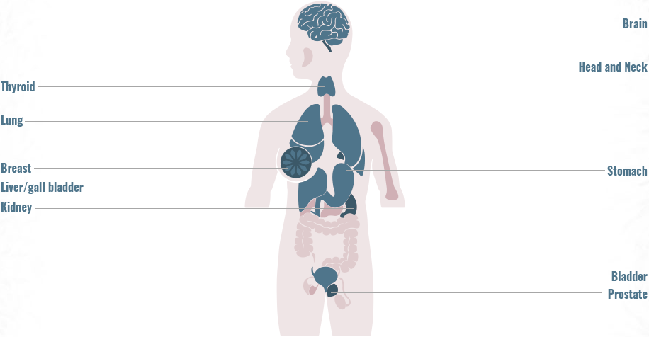 Distribution of FGFR 1,2,3 gene fusions across primary tumor sites graphic